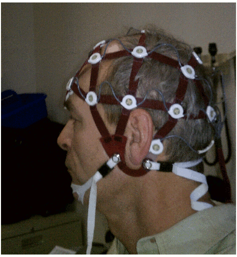 eeg photo small.gif