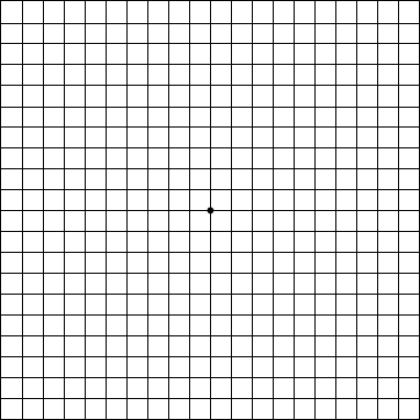 amsler-grid.gif
